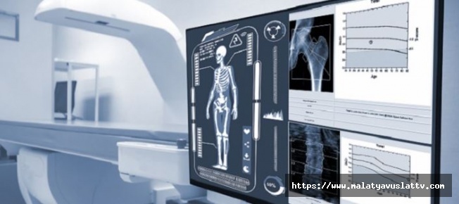Kemik Metastazı Hakkında 3 Önemli Bilgi!